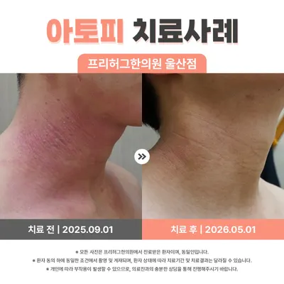 프리허그한의원 사진 3 (업체가 네이버 플레이스에 올린 사진)