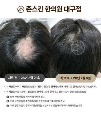존스킨한의원 사진 2 (업체가 네이버 플레이스에 올린 사진)