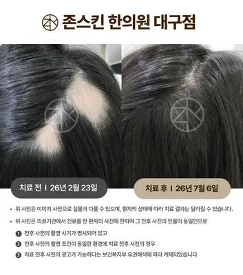 존스킨한의원 사진 3 (업체가 네이버 플레이스에 올린 사진)