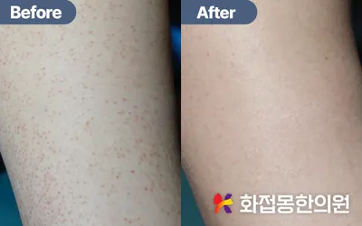 화접몽한의원 사진 3 (업체가 네이버 플레이스에 올린 사진)
