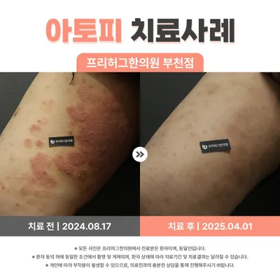 프리허그한의원 사진 3 (업체가 네이버 플레이스에 올린 사진)