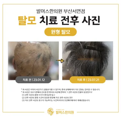 발머스한의원 사진 3 (업체가 네이버 플레이스에 올린 사진)