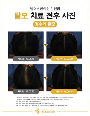 발머스한의원 사진 2 (업체가 네이버 플레이스에 올린 사진)