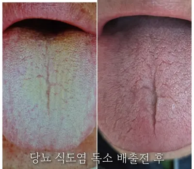민강한의원 사진 3 (업체가 네이버 플레이스에 올린 사진)