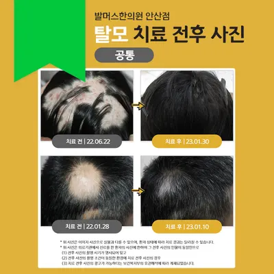 발머스한의원 사진 2 (업체가 네이버 플레이스에 올린 사진)