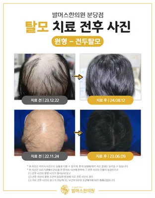 발머스한의원 사진 2 (업체가 네이버 플레이스에 올린 사진)