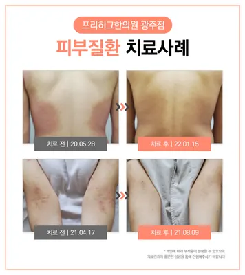 프리허그한의원 사진 3 (업체가 네이버 플레이스에 올린 사진)