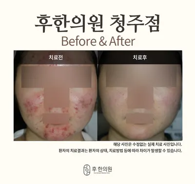 후한의원 사진 3 (업체가 네이버 플레이스에 올린 사진)