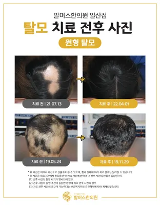 발머스한의원 사진 3 (업체가 네이버 플레이스에 올린 사진)
