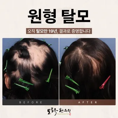 모락한의원 사진 2 (업체가 네이버 플레이스에 올린 사진)