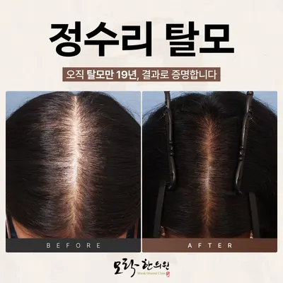 모락한의원 사진 3 (업체가 네이버 플레이스에 올린 사진)