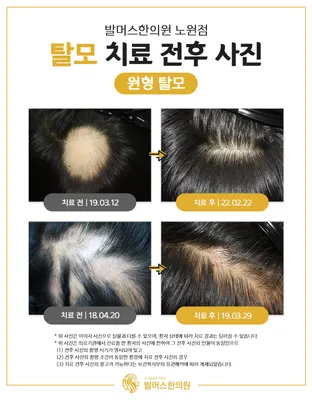 발머스한의원 사진 2 (업체가 네이버 플레이스에 올린 사진)