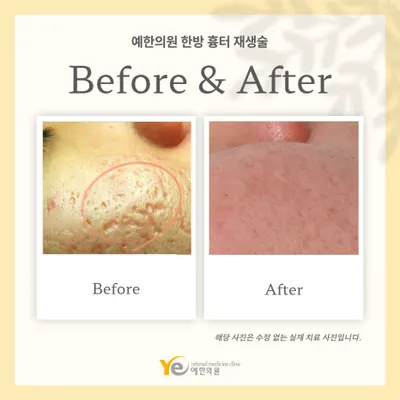 예한의원 사진 3 (업체가 네이버 플레이스에 올린 사진)
